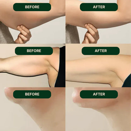 Biovega™ Lymphatic Drainage Drops
